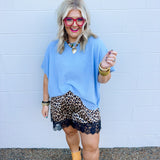 Playful Leopard Shorts