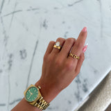KENNEDY RING